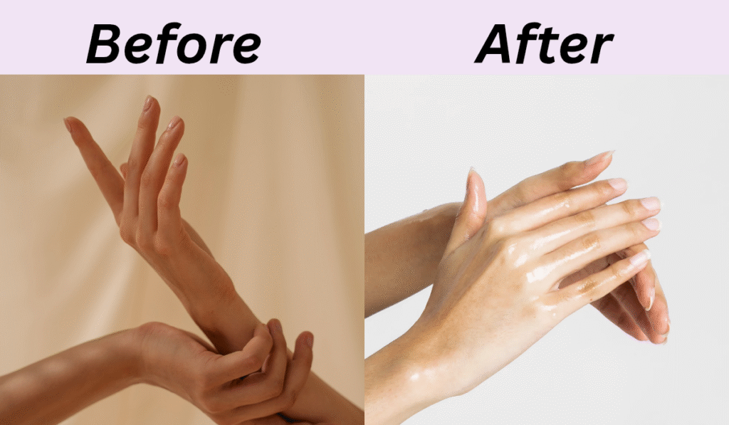 Before and after demo of skin results after using Retinol for one month (representational image)